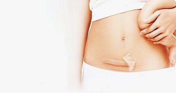 Proč jsou tlusté silikonové gelové fólie na jizvy tak oblíbené?